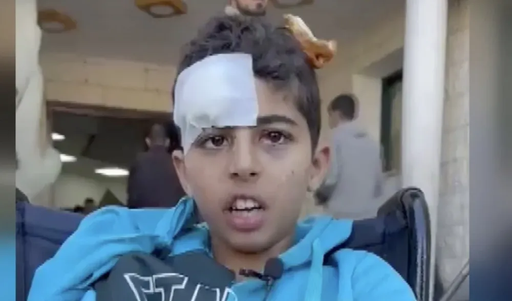 Filistinli yaralı çocuk, Cumhurbaşkanı Erdoğan
